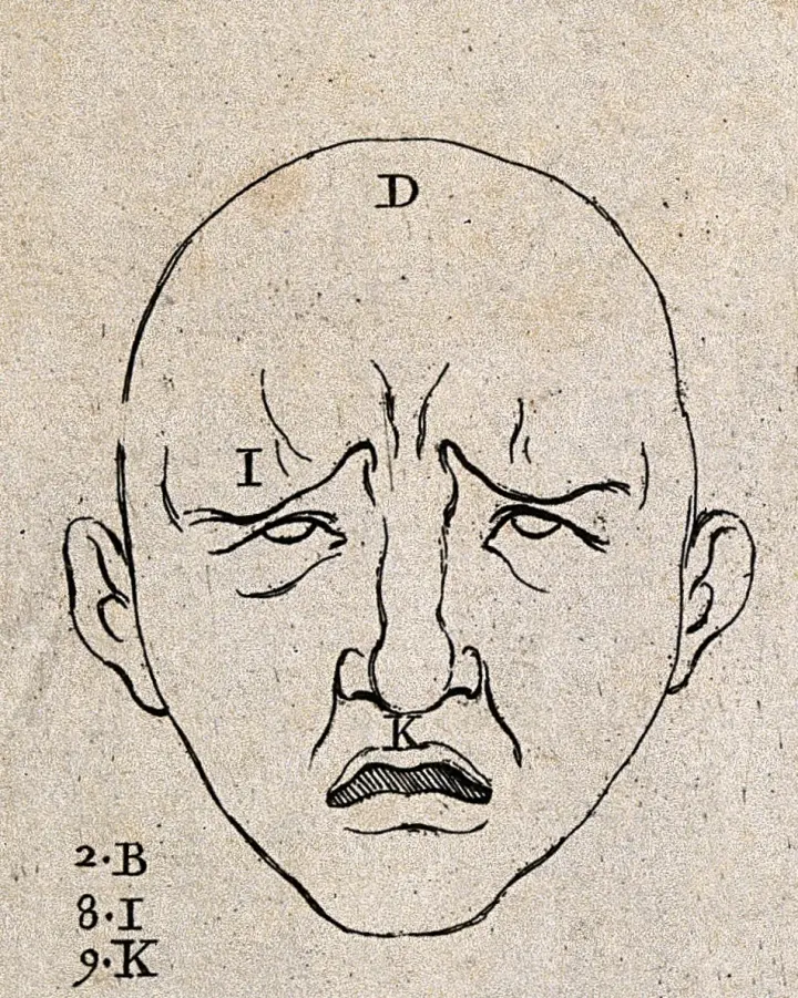 Engraved diagram of a face creased by pain